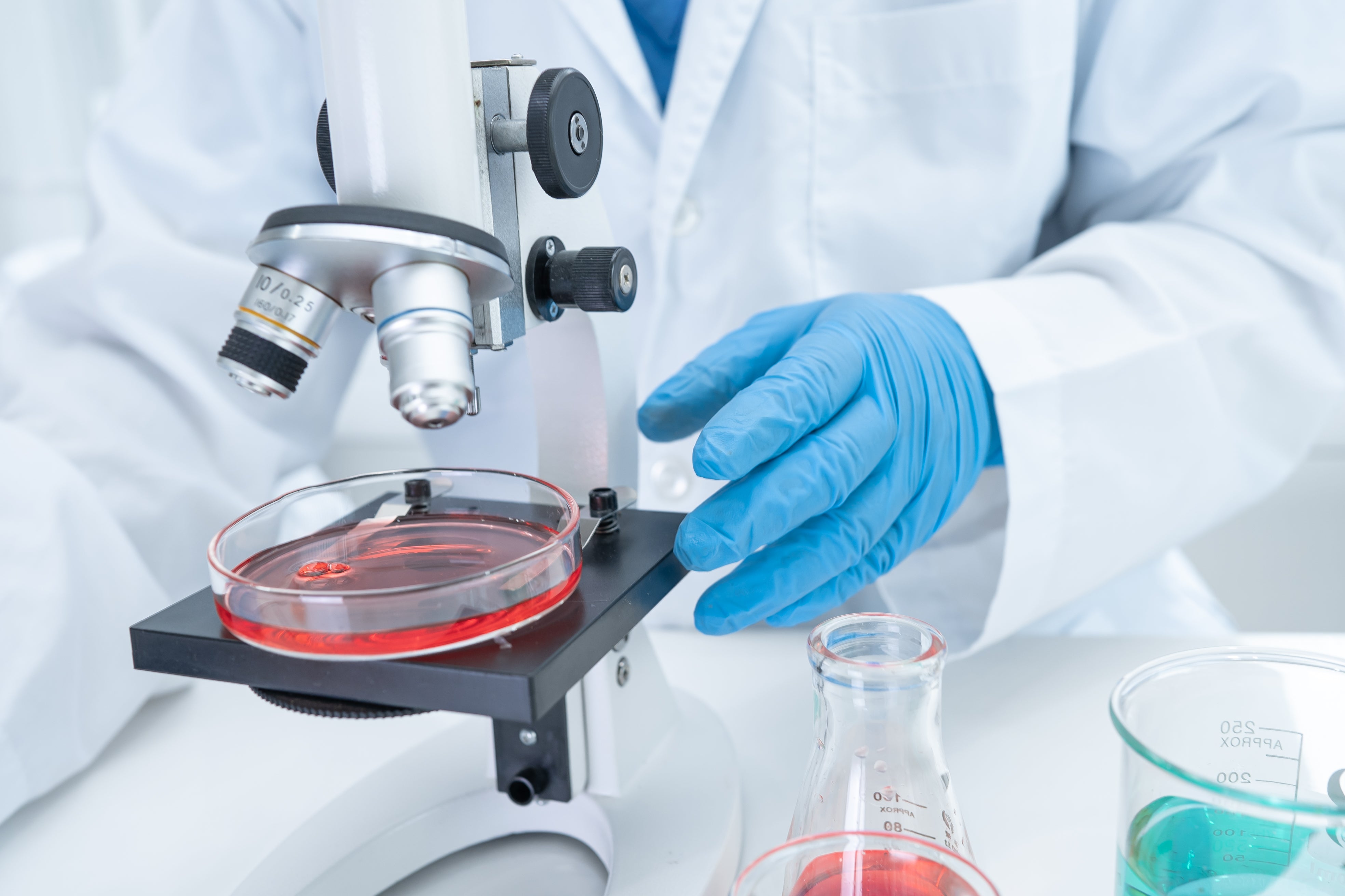 Stijging van SOA's: Een gevolg van onvoldoende investeringen in seksuele gezondheid